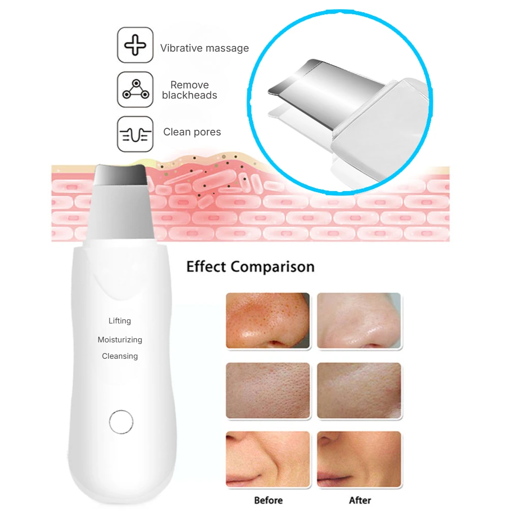Ultrasonic Skin Scrubber